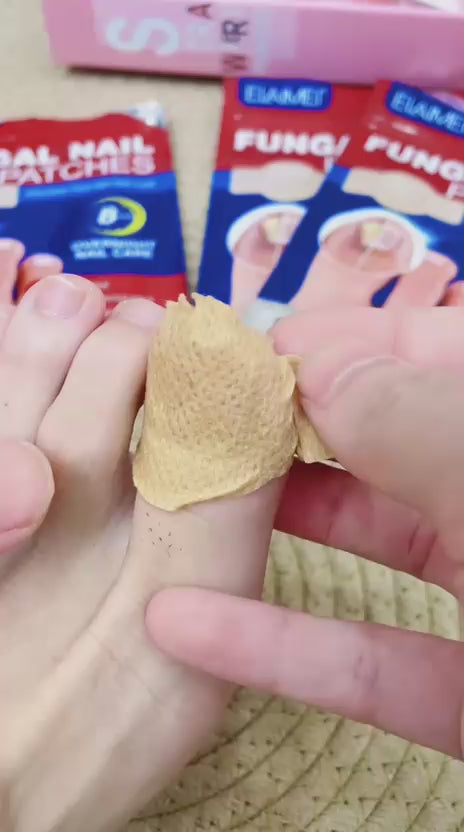 Fungal Nail Patches video